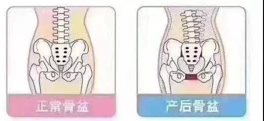 產(chǎn)后身材變形？你可能錯(cuò)過了這個(gè)……