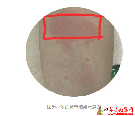 快速確認(rèn)過(guò)敏原，自由擁抱春天